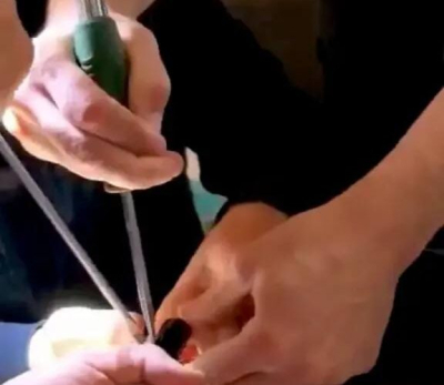 В Казани спасатели вызволили палец пятилетнего мальчика из металлической ловушки 12/03/2026 &ndash; Новости